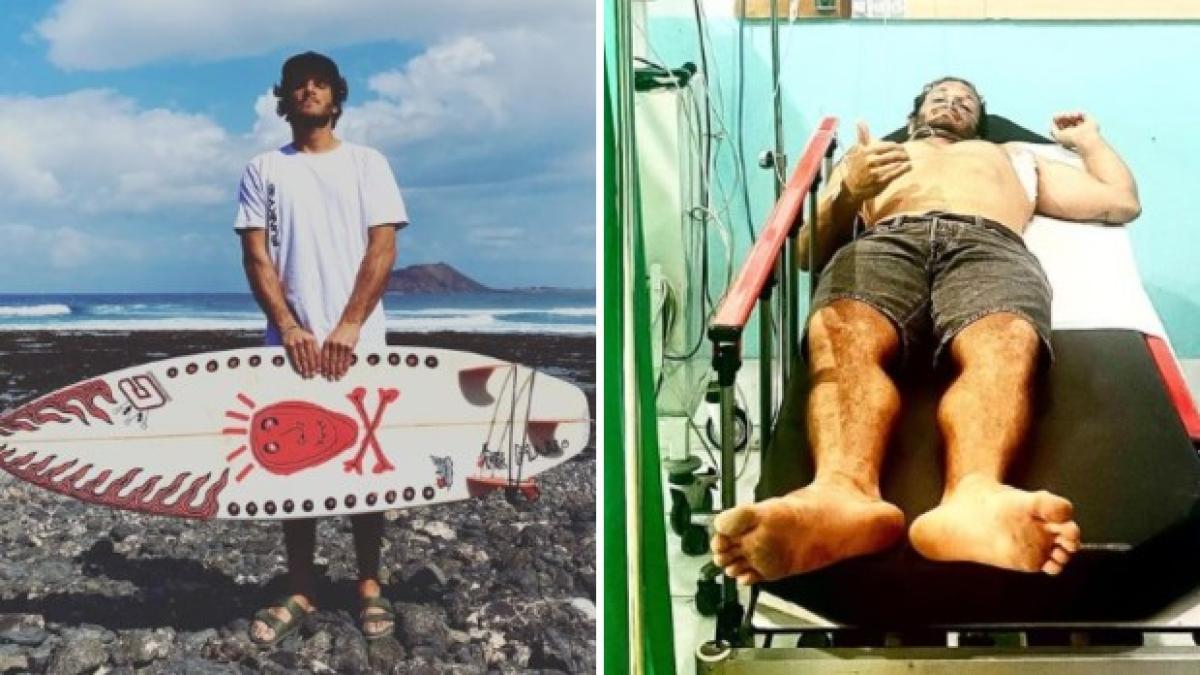 Surfista italià traspassat per un peix agulla a Indonèsia: l'accident