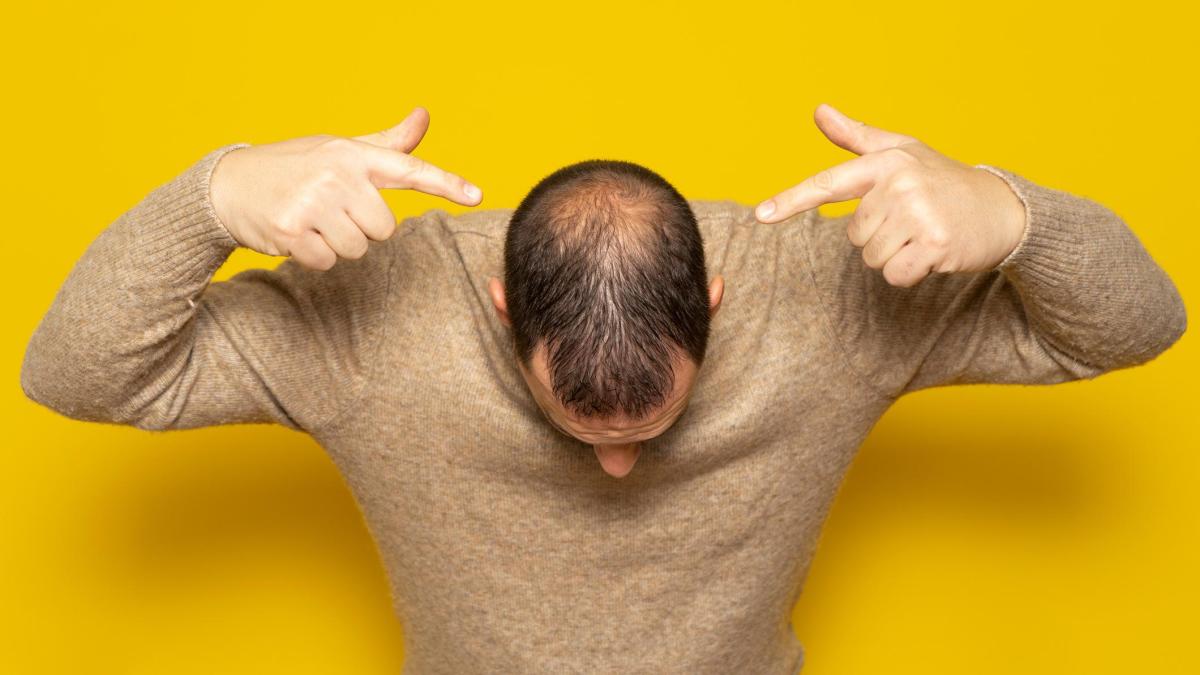 Minoxidil cabell: què és, com utilitzar-lo i quins efectes secundaris